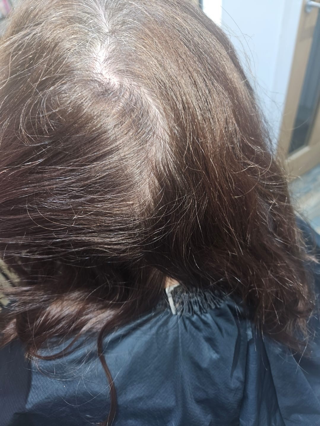 Roots - Before
